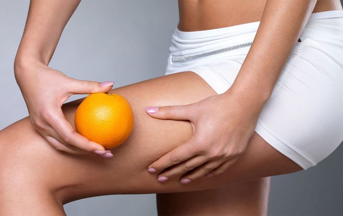 Kako se riješiti celulita na aromaterapeutski način?