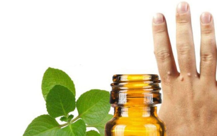 Liječenje bradavica prirodnim putem