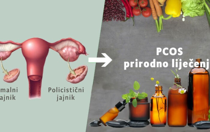 PCOS prirodno liječenje