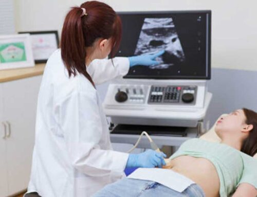Veličina mioma za operaciju – kada je potreban zahvat?